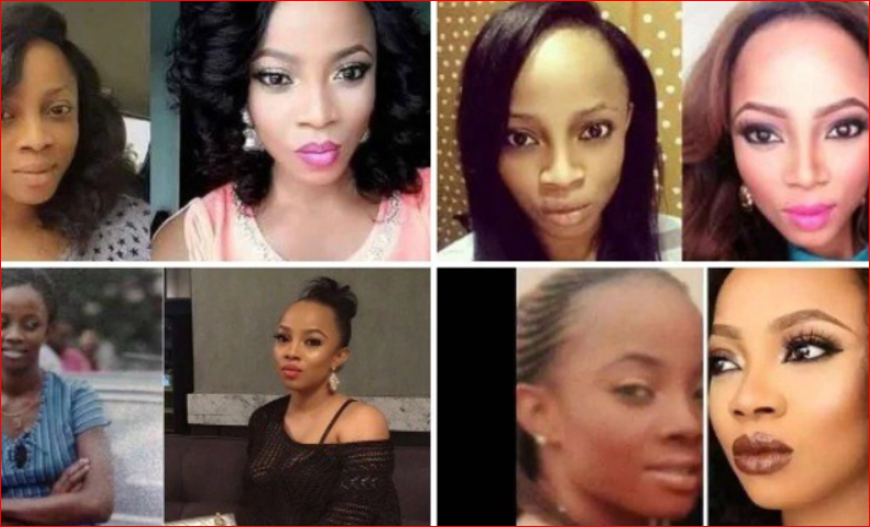 Skin Bleaching: What You Should Know About